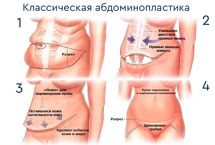 Фото До и После женской интимной пластики, результаты работ